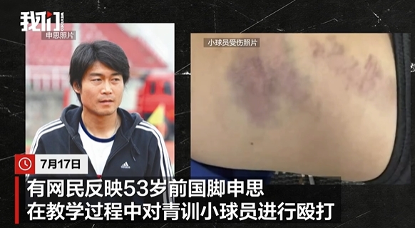 申思掌掴小球员后续:俱乐部称其顾问身份,家长已报警 申思掌掴小球员后续:俱乐部称其顾问身份,家长已报警